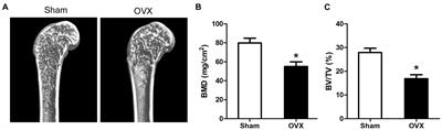 Expression Profile Analysis of Long Non-coding RNA in OVX Models-Derived BMSCs for Postmenopausal Osteoporosis by RNA Sequencing and Bioinformatics